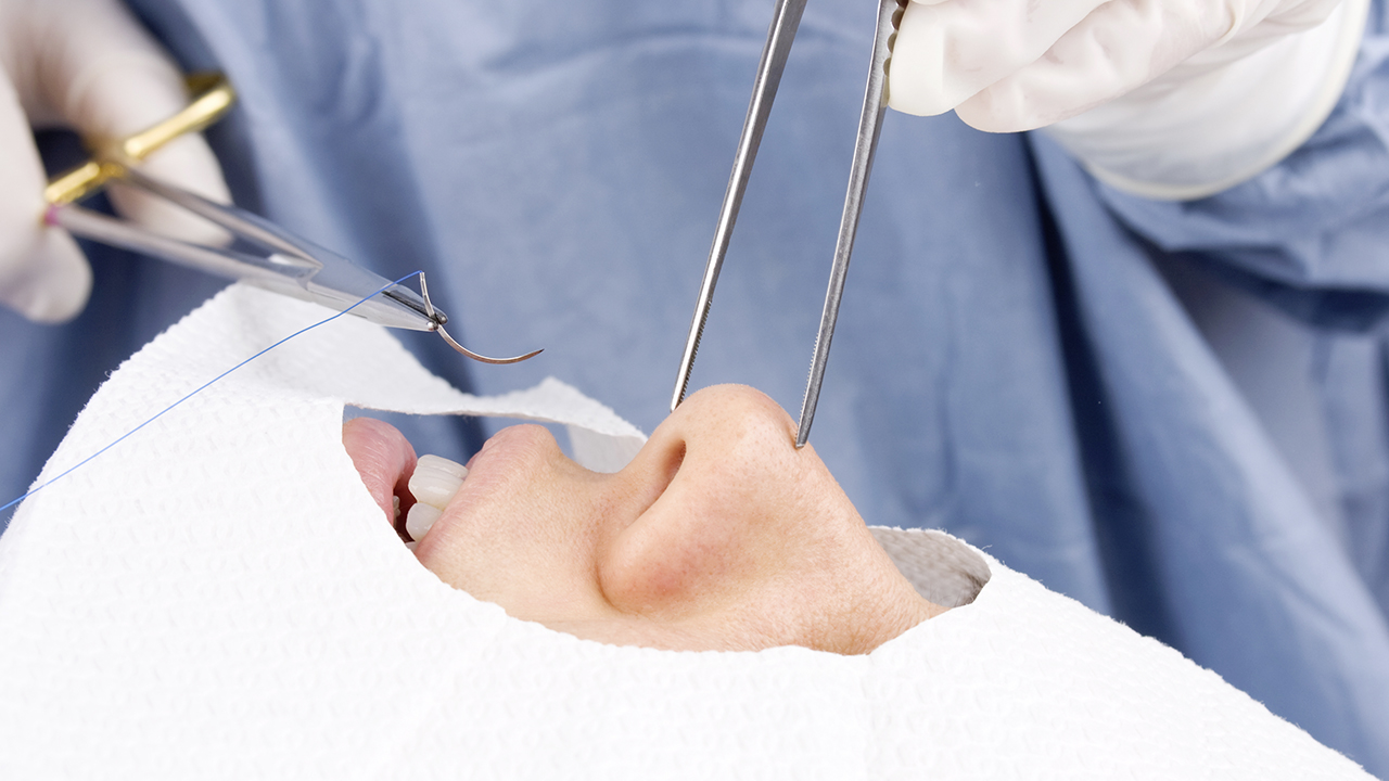 intervention esthétique